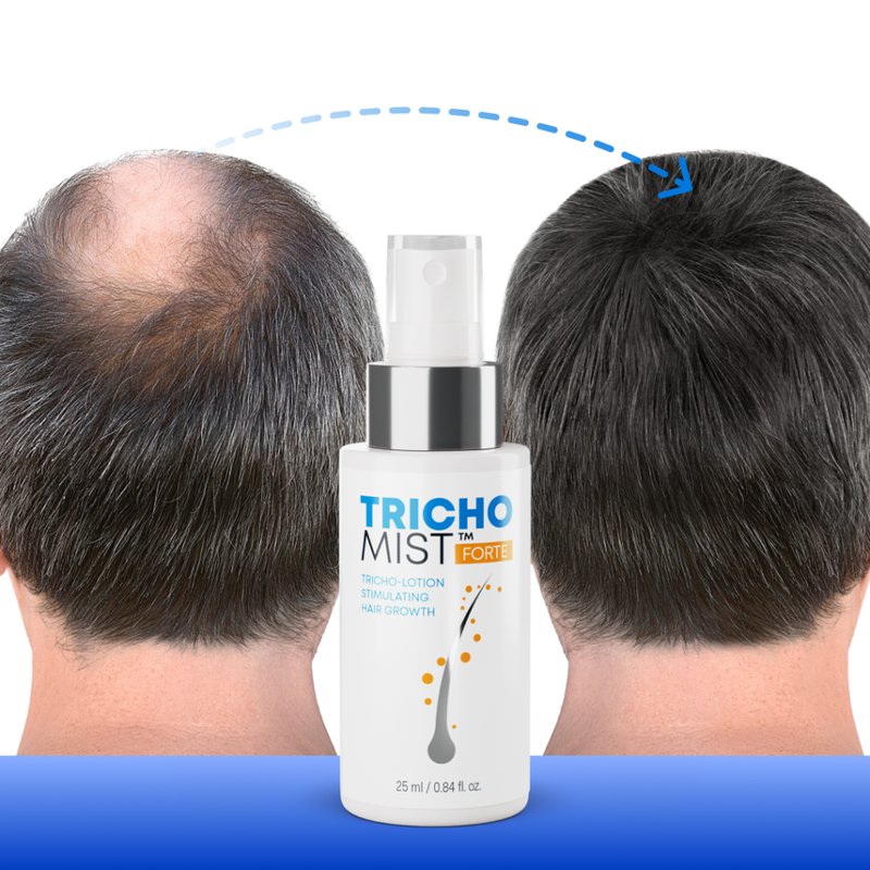 Trichomist Forte w porównaniu do innych produktów na rynku - overview